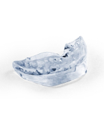 Fitted SnorBan®
